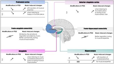 Musical experience prior to traumatic exposure as a resilience factor: a conceptual analysis